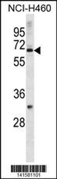 ZNF185 Antibody(N-term)