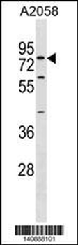 SYT16 Antibody(Center)
