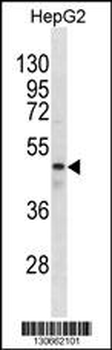 GABRR1 Antibody(N-term)