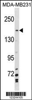 MYBBP1A Antibody(N-term)