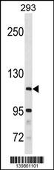SH3BP4 Antibody(Center)