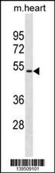Mouse Hoxa10 Antibody(Center)