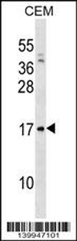 VPREB1 Antibody (Center)