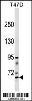 RHPN2 Antibody (Center)