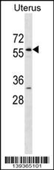 LEMD2 Antibody (N-term)