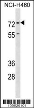 ENAH Antibody (C-term)