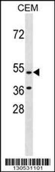 GPR109B Antibody (N-term)