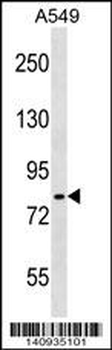IKK alpha/IKK beta Antibody (Center)