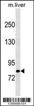 Mouse Cblb Antibody (C-term)