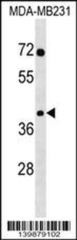 SNAPC3 Antibody (Center)
