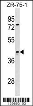 SIRPB2 Antibody (C-term)
