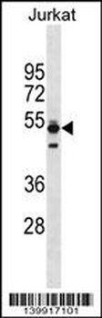 TMPO Antibody (Center)