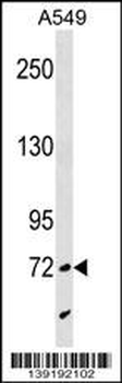 SYTL4 Antibody (N-term)