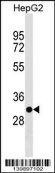 TARM1 Antibody (C-term)