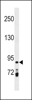 PRICKLE1 Antibody (C-term)