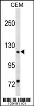 MKL1 Antibody (Center)