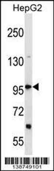 DHX36 Antibody (Center)
