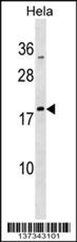 MRPL48 Antibody (N-term)