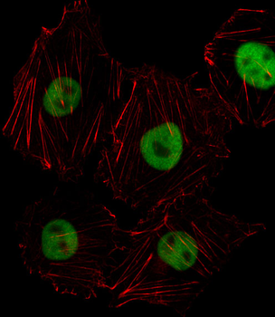 HOXD8 Antibody (C-term)