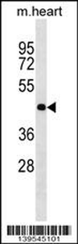 OLIG2 Antibody (Center)