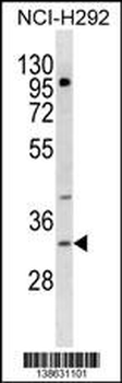 TREML1 Antibody (C-term)