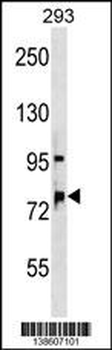 OSBPL11 Antibody (N-term)