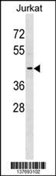 KCNAB3 Antibody (Center)
