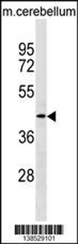 TMOD2 Antibody (N-term)