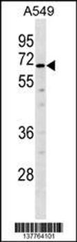 TULP2 Antibody (Center)