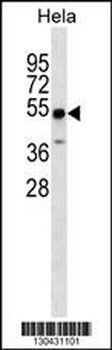 ZSCAN4 Antibody (N-term)