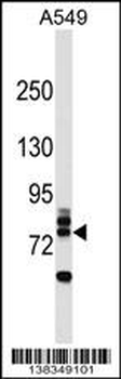 RNF157 Antibody (N-term)