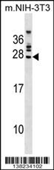 FGFR1OP2 Antibody (Center)