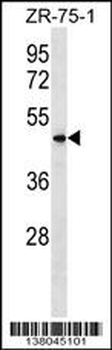 VN1R5 Antibody (Center)
