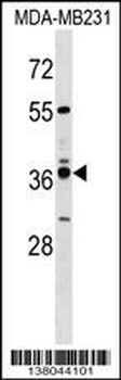 VN1R4 Antibody (Center)