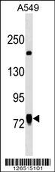 LINS1 Antibody (C-term)