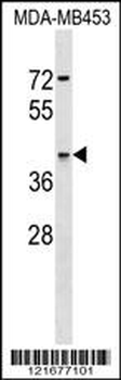 ARSA Antibody (C-term)