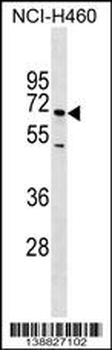SELE Antibody