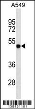 ZSCAN1 Antibody (C-term)