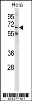 GLT11 Antibody (N-term)
