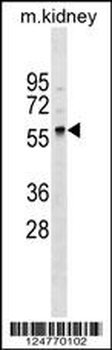 GLT11 Antibody (N-term)
