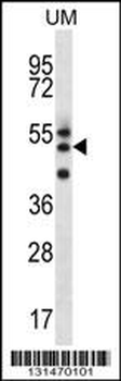 RMD2 Antibody (Center)