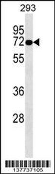 OTOP2 Antibody (Center)