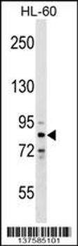 ZNF224 Antibody (N-term)