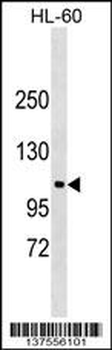 NDST3 Antibody (C-term)