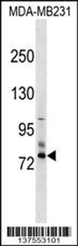 SCNN1D Antibody (N-term)