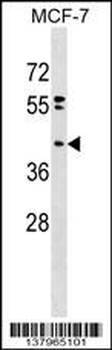 PPAPDC2 Antibody (N-term)