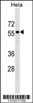 AMIGO3 Antibody (Center)