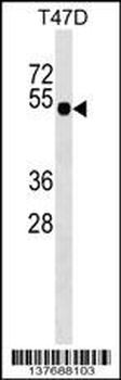 GLI4 Antibody (N-term)