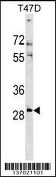 RNF138 Antibody (Center)