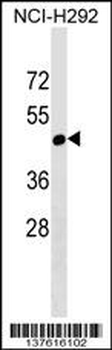 RGL4 Antibody (N-term)